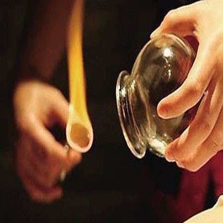 桂林专业玻璃拔罐